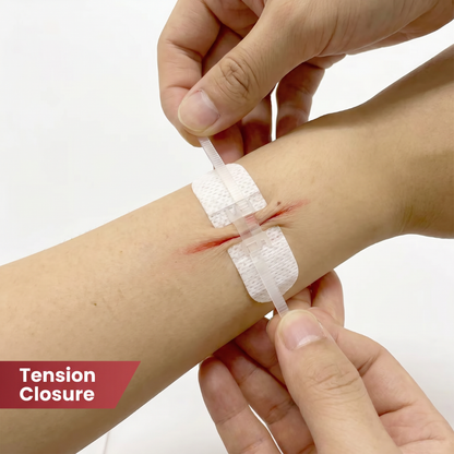 Hardeyy WildMed Wound Closure Strip Kit